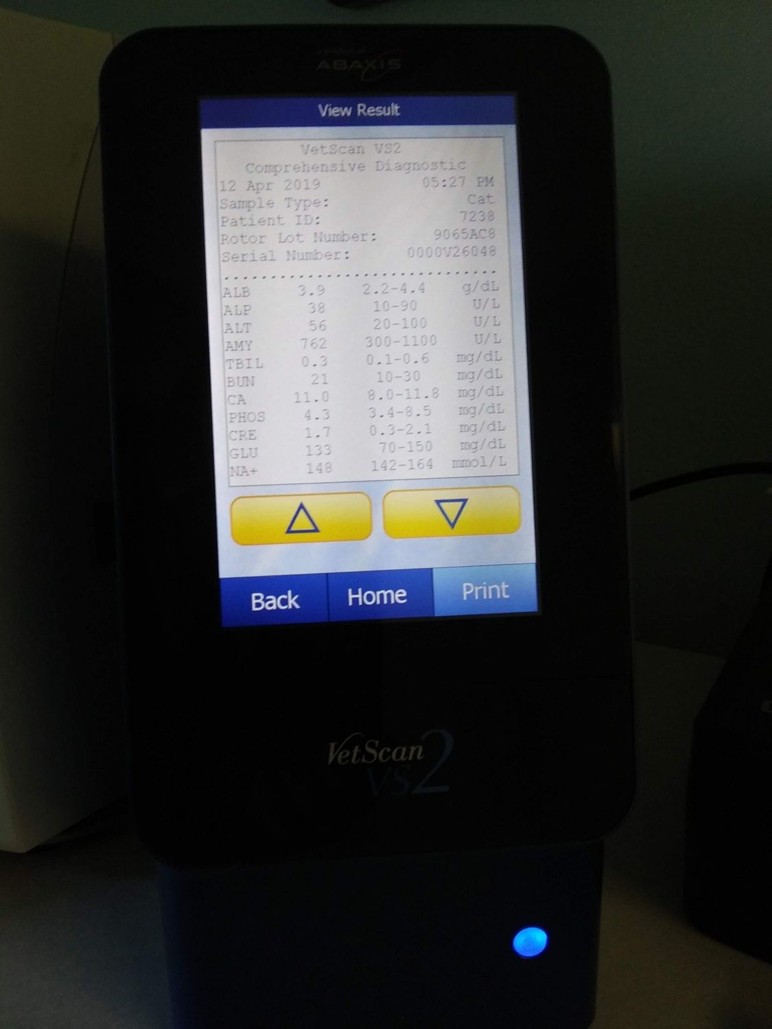 urinalysis